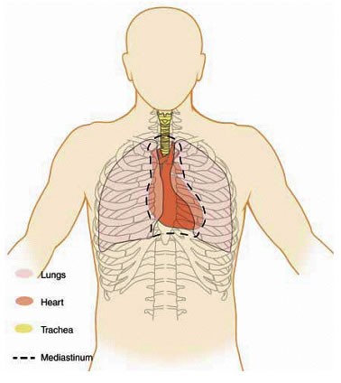 lungcancerfig Lung Cancer Diagramm