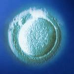 frozen oocyte
